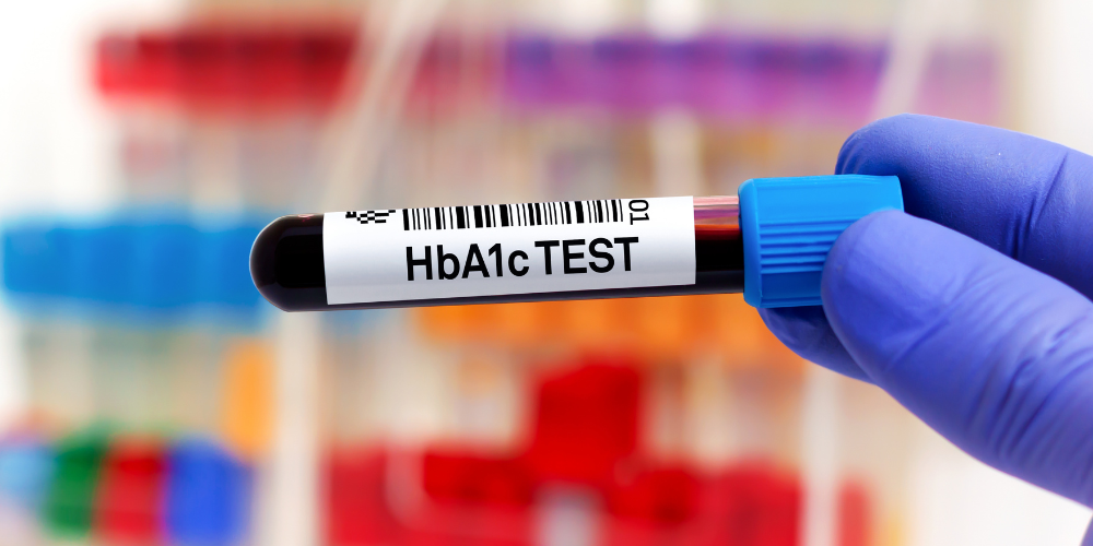 HbA1c Test Price in Bangladesh: Cost and Hospital for 2026