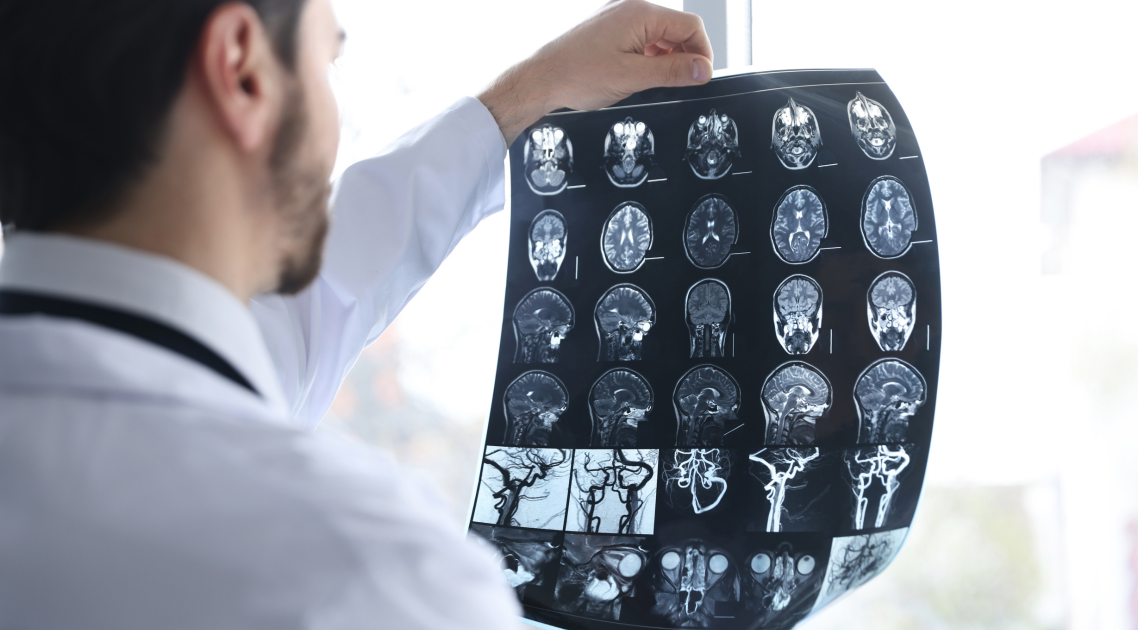 MRI of Brain Cost in Bangladesh