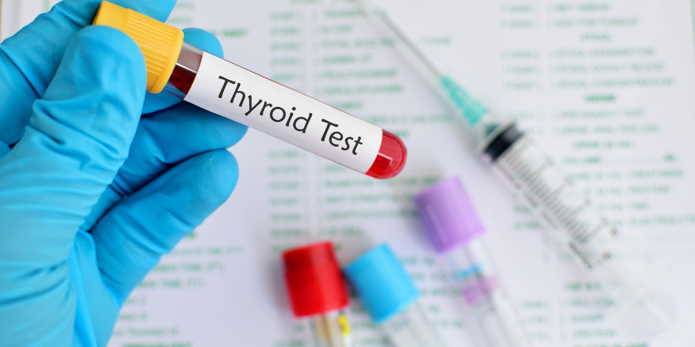 TSH Test Price in Bangladesh 2026 | Hospitals, Labs & Full Details